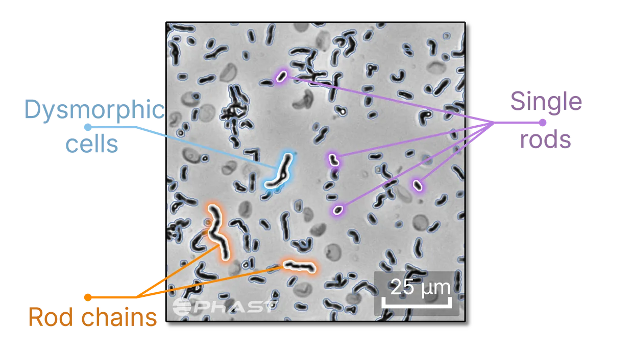 Single cell analysis